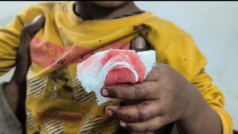 ભાણવડમાં ત્રાટકેલા શિયાળે માસુમ બાળકને કર્યો ઇજાગ્રસ્ત